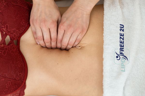 diastasis recti treatment Surbiton