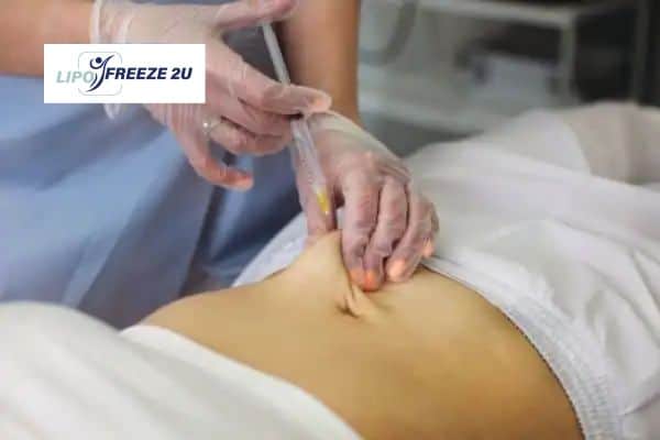 How Does Aqualyx Fat Dissolving Injection Work to Break Down Fat Surbiton?