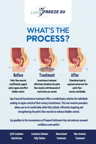 Diagram of how incontinence treatment Surbiton works.