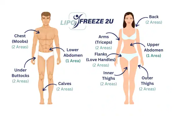 Areas you can have fat freezing treatment Surbiton
