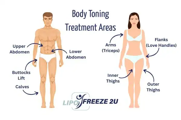 Graphic showing where you can have Body toning Treatment Surbiton on your body