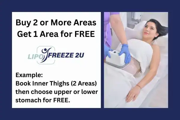 fat freezing prices Surbiton