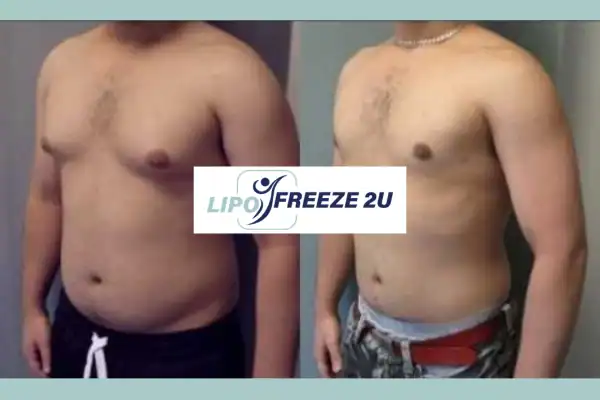 How Long Does It Take to See Results Surbiton?
