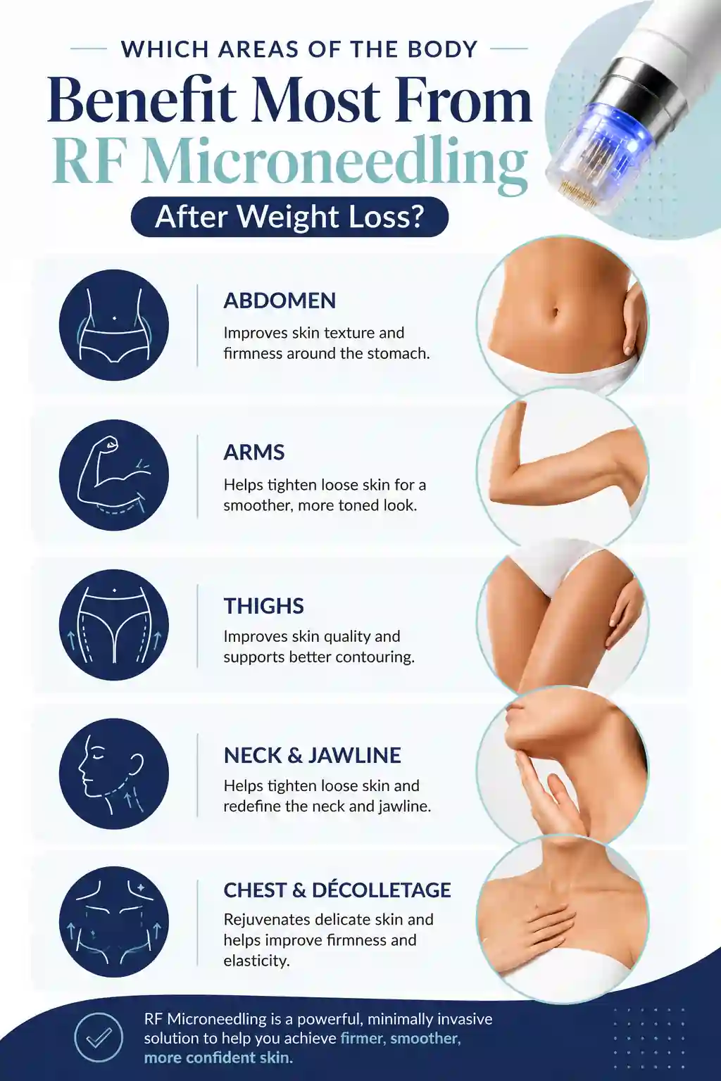 Which Areas of the Body Benefit Most From RF Microneedling After Weight Loss Surbiton